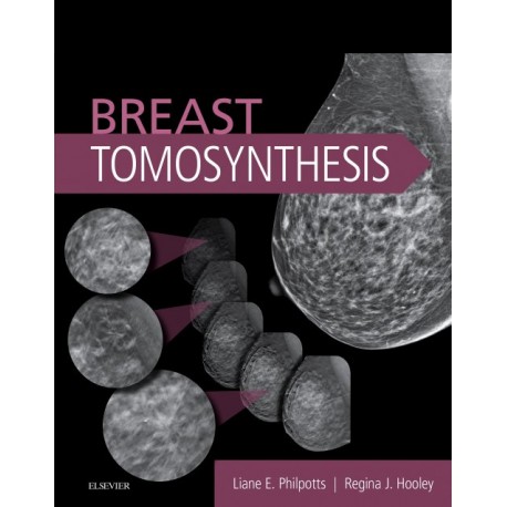 Breast Tomosynthesis (ebook) - Envío Gratuito