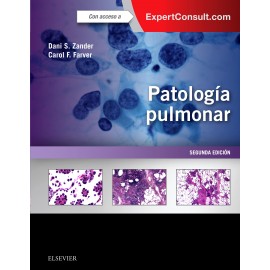 Patología pulmonar + ExpertConsult (ebook) - Envío Gratuito