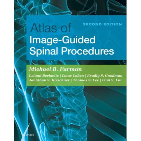 Atlas of Image-Guided Spinal Procedures E-Book (ebook) - Envío Gratuito