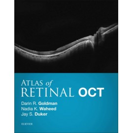 Atlas of Retinal OCT E-Book (ebook) - Envío Gratuito