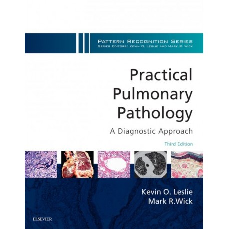 Practical Pulmonary Pathology: A Diagnostic Approach E-Book (ebook) - Envío Gratuito