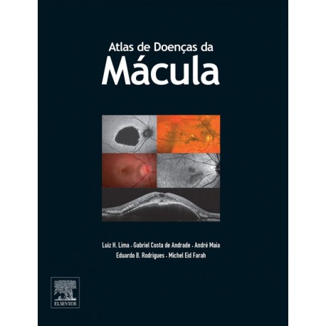 Atlas de Doenças de Mácula (ebook) - Envío Gratuito