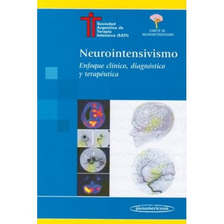 Neurointensivismo enfoque clínico, diagnóstico y terapéutica - Envío Gratuito