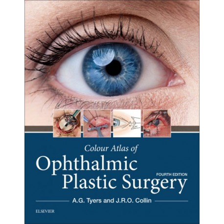 Colour Atlas of Ophthalmic Plastic Surgery E-Book (ebook) - Envío Gratuito