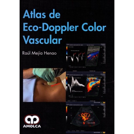 Atlas de Eco-Doppler Color Vascular - Envío Gratuito