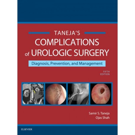Complications of Urologic Surgery E-Book (ebook) - Envío Gratuito