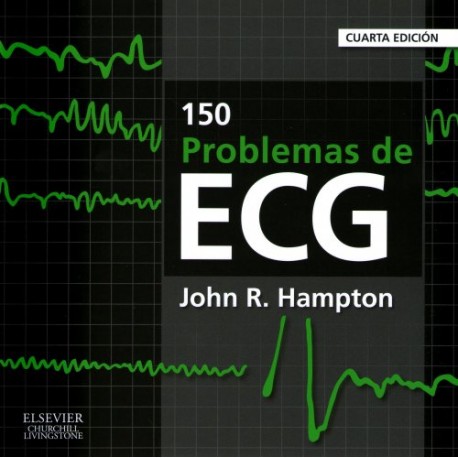 150 problemas de ECG - Envío Gratuito