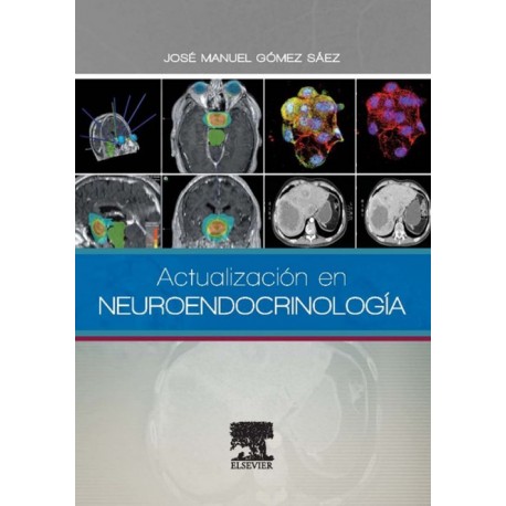 Actualización en Neuroendocrinología - Envío Gratuito