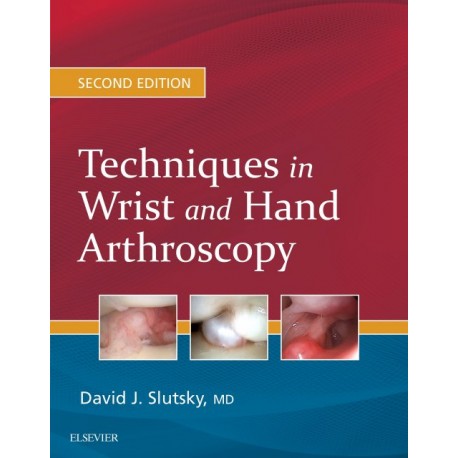 Techniques in Wrist and Hand Arthroscopy (ebook) - Envío Gratuito