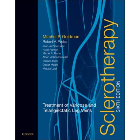 Sclerotherapy (ebook) - Envío Gratuito