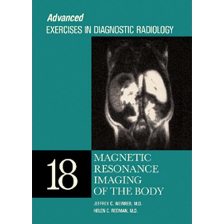 Magnetic Resonance Imaging of the Body (ebook) - Envío Gratuito