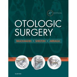 Otologic Surgery (ebook) - Envío Gratuito