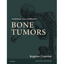 Dorfman and Czerniak?s Bone Tumors (ebook) - Envío Gratuito