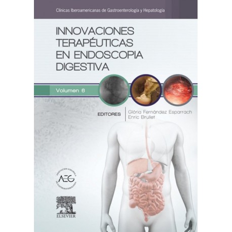 Innovaciones terapéuticas en endoscopia digestiva (ebook) - Envío Gratuito