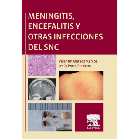 Meningitis, encefalitis y otras infecciones del SNC (ebook) - Envío Gratuito