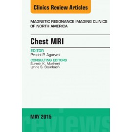 Chest MRI, An Issue of Magnetic Resonance Imaging Clinics of North America, (ebook) - Envío Gratuito