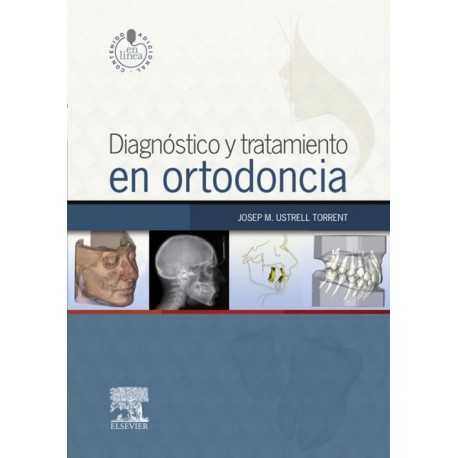 Diagnóstico y tratamiento en ortodoncia + StudentConsult en español (ebook) - Envío Gratuito