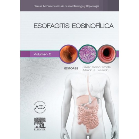 Esofagitis eosinofílica (ebook) - Envío Gratuito