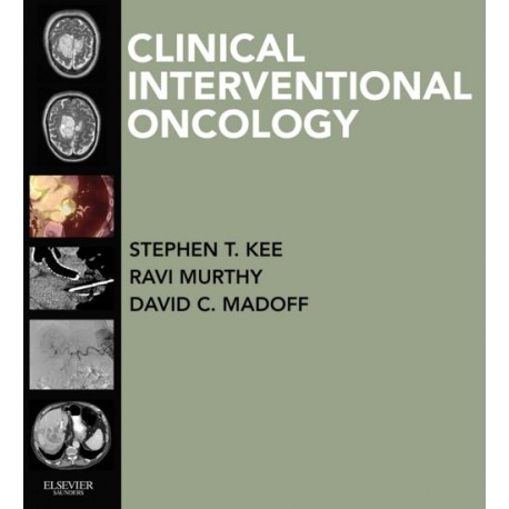 Clinical Interventional Oncology (ebook) - Envío Gratuito