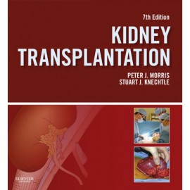 Kidney Transplantation - Principles and Practice (ebook) - Envío Gratuito