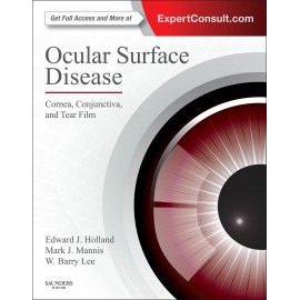 Ocular Surface Disease: Cornea, Conjunctiva and Tear Film (ebook) - Envío Gratuito