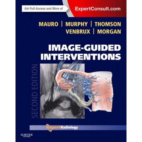 Image-Guided Interventions (ebook) - Envío Gratuito