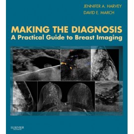 Making the Diagnosis: A Practical Guide to Breast Imaging (ebook) - Envío Gratuito