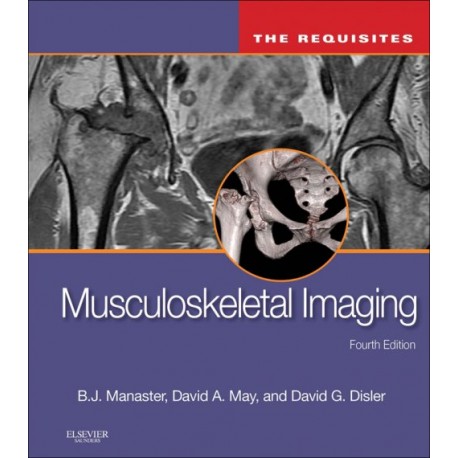 Musculoskeletal Imaging: The Requisites (ebook) - Envío Gratuito