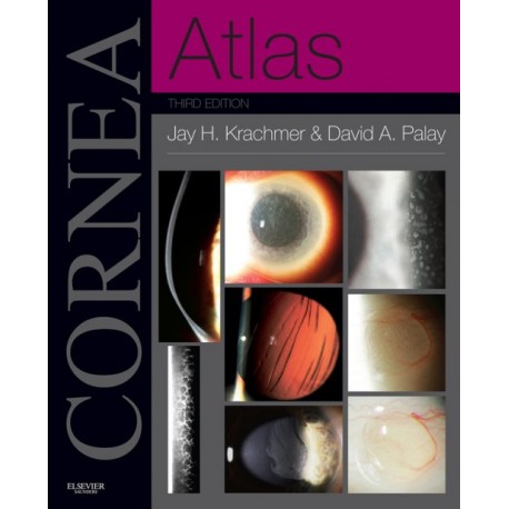 Cornea Atlas (ebook) - Envío Gratuito