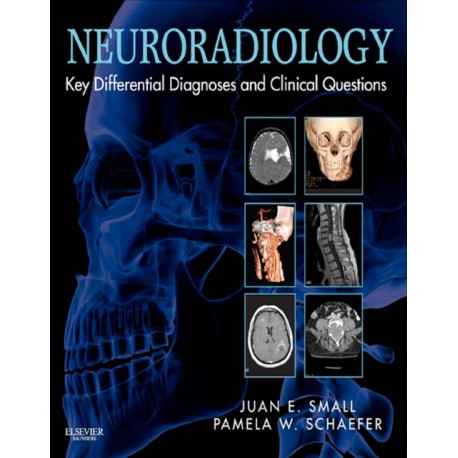 Neuroradiology: Key Differential Diagnoses and Clinical Questions (ebook) - Envío Gratuito