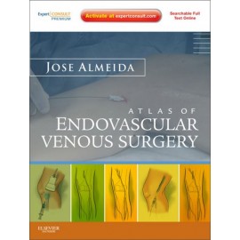 Atlas of Endovascular Venous Surgery (ebook) - Envío Gratuito