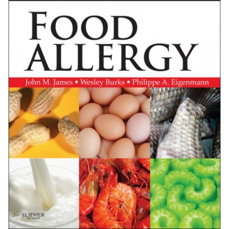 Food Allergy (ebook) - Envío Gratuito