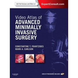 Video Atlas of Advanced Minimally Invasive Surgery (ebook) - Envío Gratuito