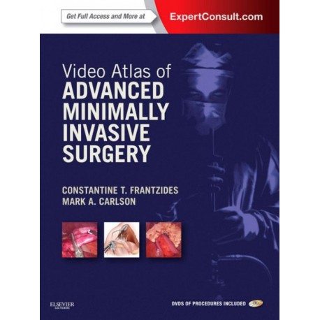 Video Atlas of Advanced Minimally Invasive Surgery (ebook) - Envío Gratuito