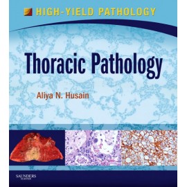 Thoracic Pathology (ebook) - Envío Gratuito