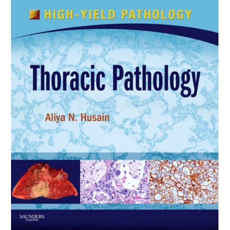 Thoracic Pathology (ebook) - Envío Gratuito