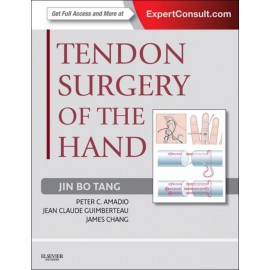 Tendon Surgery of the Hand (ebook) - Envío Gratuito