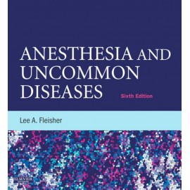 Anesthesia and Uncommon Diseases (ebook) - Envío Gratuito