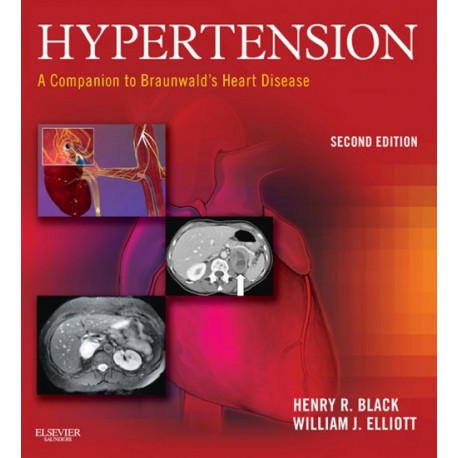 Hypertension: A Companion to Braunwald's Heart Disease (ebook) - Envío Gratuito