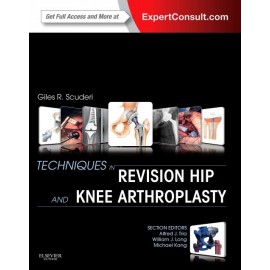 Techniques in Revision Hip and Knee Arthroplasty (ebook) - Envío Gratuito