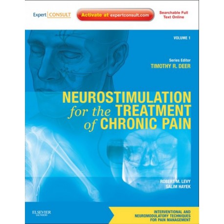 Neurostimulation for the Treatment of Chronic Pain (ebook) - Envío Gratuito