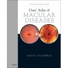 Gass' Atlas of Macular Diseases (ebook) - Envío Gratuito