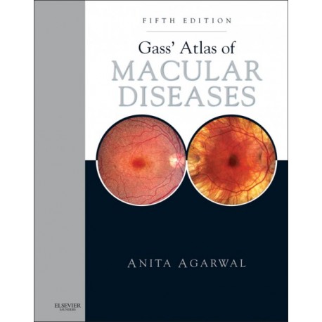 Gass' Atlas of Macular Diseases (ebook) - Envío Gratuito