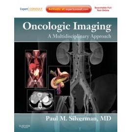 Oncologic Imaging: A Multidisciplinary Approach (ebook) - Envío Gratuito