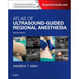 Atlas of Ultrasound-Guided Regional Anesthesia (ebook) - Envío Gratuito