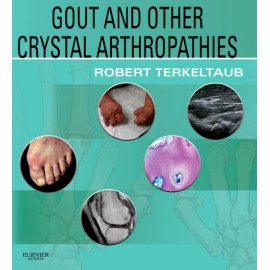 Gout & Other Crystal Arthropathies (ebook) - Envío Gratuito