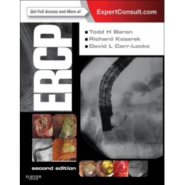 ERCP (ebook) - Envío Gratuito