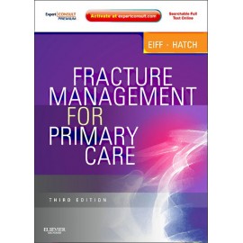 Fracture Management for Primary Care (ebook) - Envío Gratuito