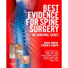 Best Evidence for Spine Surgery (ebook) - Envío Gratuito