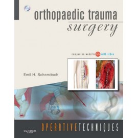 Operative Techniques: Orthopaedic Trauma Surgery (ebook) - Envío Gratuito